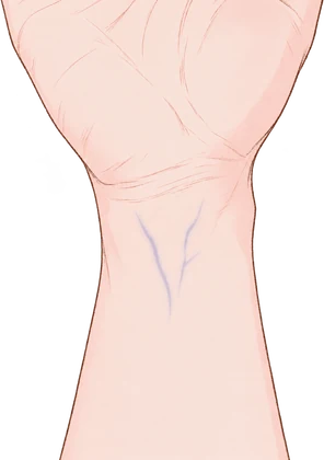 血管が青・紫っぽく見える手首のイラスト